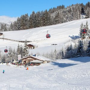 Kitzalm